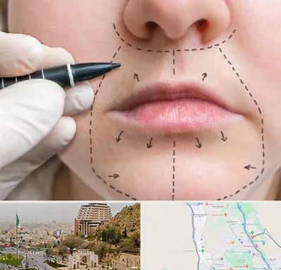 عمل سانترال لب در فرهنگ شهر شیراز