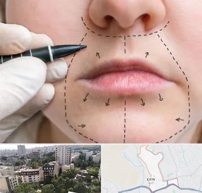 عمل سانترال لب در اوین