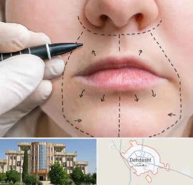 عمل سانترال لب در دهدشت