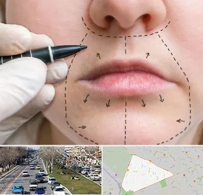 عمل سانترال لب در احمدآباد مشهد