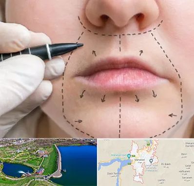 عمل سانترال لب در مهاباد