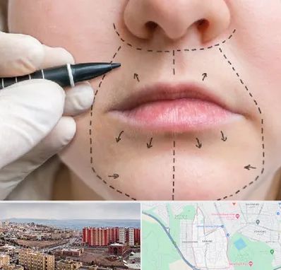 عمل سانترال لب در سهند تبریز