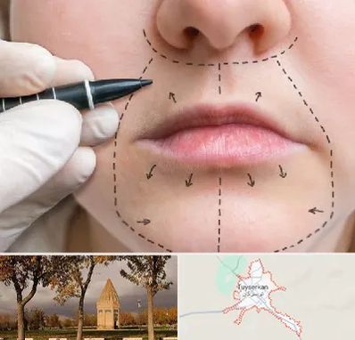 عمل سانترال لب در تویسرکان