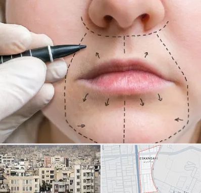 عمل سانترال لب در اسکندری