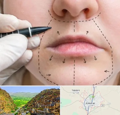 عمل سانترال لب در کامیاران