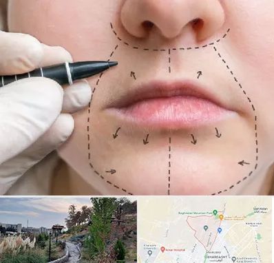 عمل سانترال لب در باغستان کرج