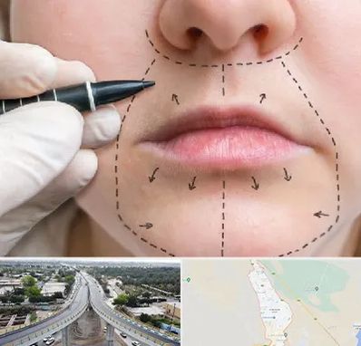 عمل سانترال لب در اندیمشک