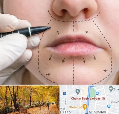 عمل سانترال لب در چهارباغ اصفهان