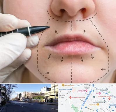 عمل سانترال لب در خیابان ملاصدرا شیراز