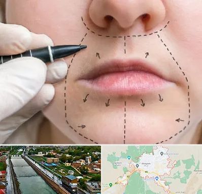 عمل سانترال لب در مراغه