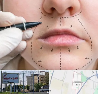 عمل سانترال لب در فاز یک اندیشه