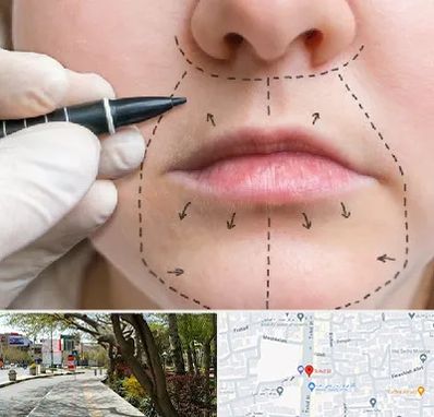 عمل سانترال لب در خیابان توحید اصفهان