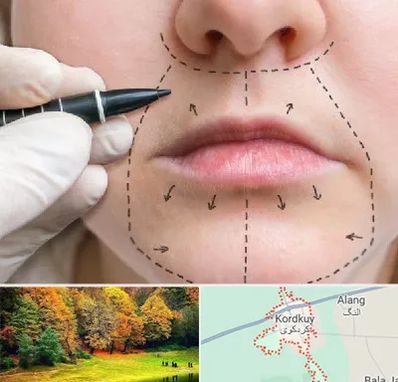 عمل سانترال لب در کردکوی