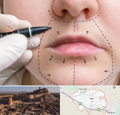عمل سانترال لب در بم