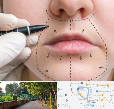 عمل سانترال لب در فلکه گاز رشت