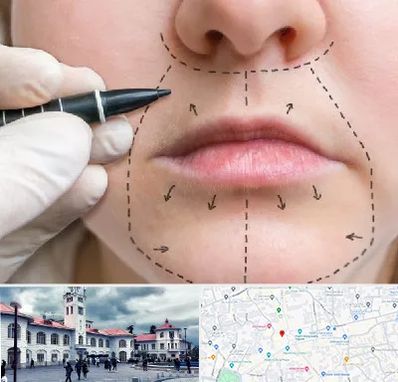 عمل سانترال لب در میدان شهرداری رشت