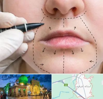 عمل سانترال لب در آستانه اشرفیه