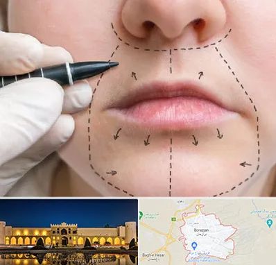 عمل سانترال لب در برازجان