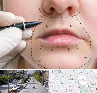 عمل سانترال لب در خیابان زند شیراز