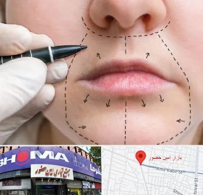 عمل سانترال لب در امین حضور