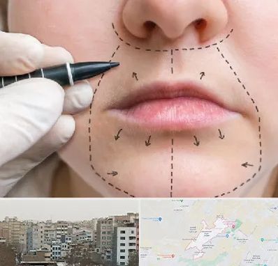 عمل سانترال لب در محمد شهر کرج