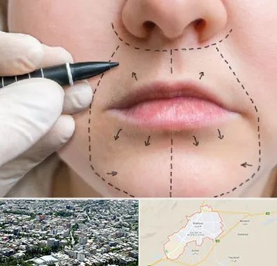 عمل سانترال لب در شاهرود