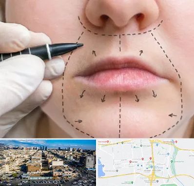 عمل سانترال لب در شهرک راه آهن