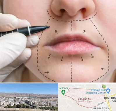 عمل سانترال لب در شهرک گلستان شیراز