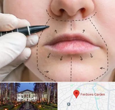 عمل سانترال لب در باغ فردوس