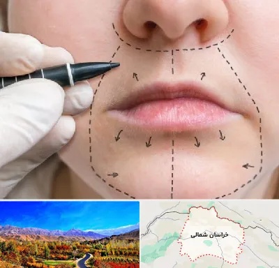 عمل سانترال لب در خراسان شمالی
