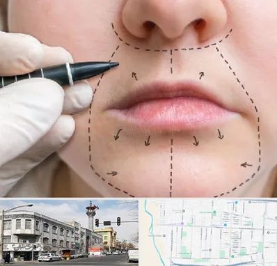 عمل سانترال لب در 17شهریور