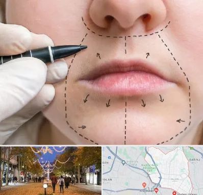 عمل سانترال لب در ولیعصر ارومیه