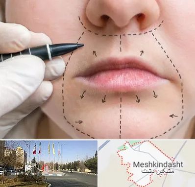 عمل سانترال لب در مشکین دشت