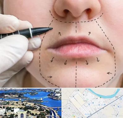 عمل سانترال لب در کوروش اهواز