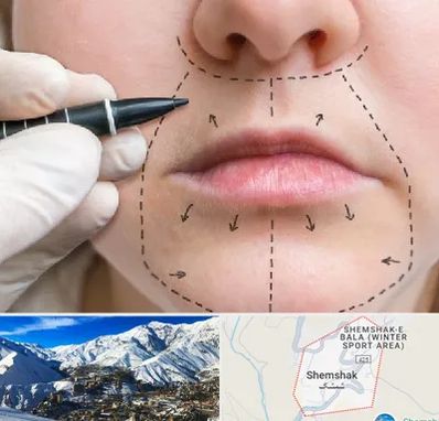عمل سانترال لب در شمشک