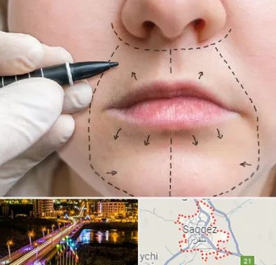 عمل سانترال لب در سقز