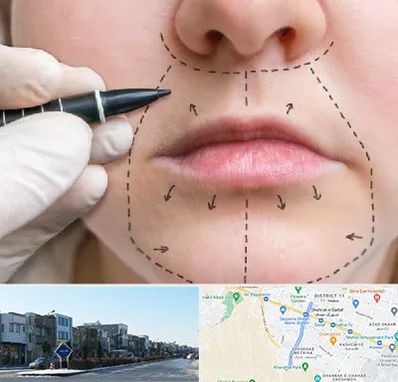 عمل سانترال لب در شریعتی مشهد