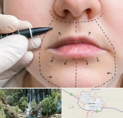 عمل سانترال لب در شیروان