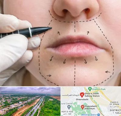 عمل سانترال لب در قصرالدشت شیراز