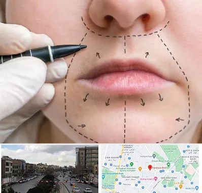 عمل سانترال لب در بلوار فردوسی مشهد