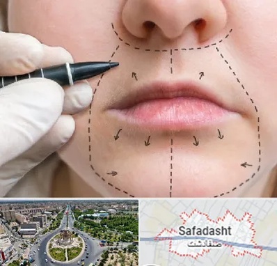 عمل سانترال لب در صفادشت