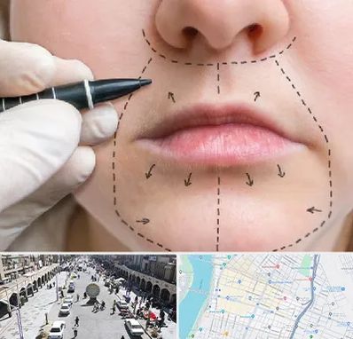 عمل سانترال لب در نادری اهواز