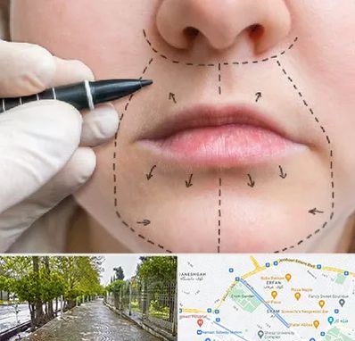 عمل سانترال لب در خیابان ارم شیراز