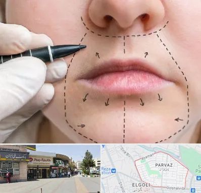 عمل سانترال لب در پرواز تبریز