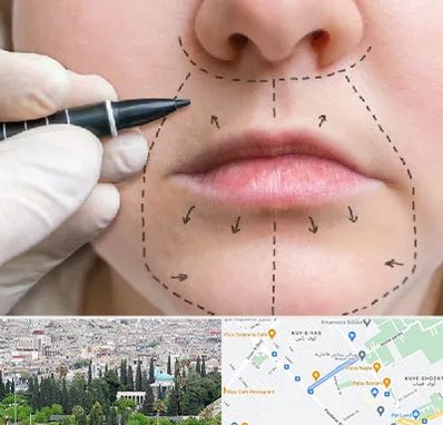 عمل سانترال لب در محلاتی شیراز