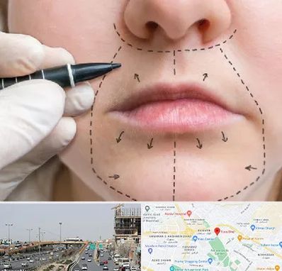 عمل سانترال لب در بلوار توس مشهد