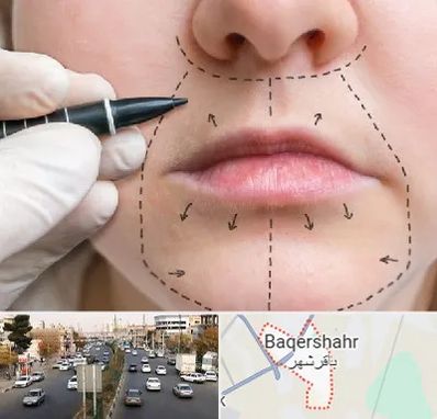 عمل سانترال لب در باقرشهر