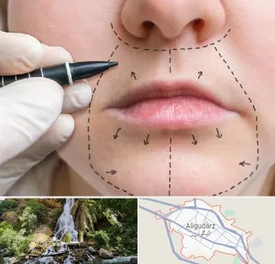 عمل سانترال لب در الیگودرز