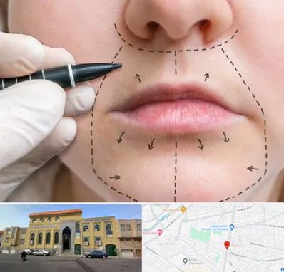 عمل سانترال لب در زنبیل آباد قم