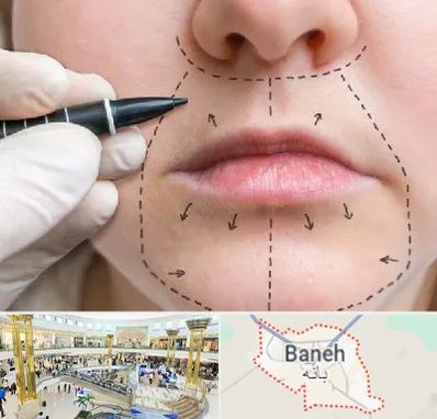 عمل سانترال لب در بانه